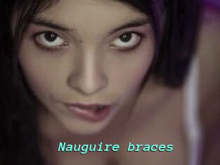 Nauguire_braces